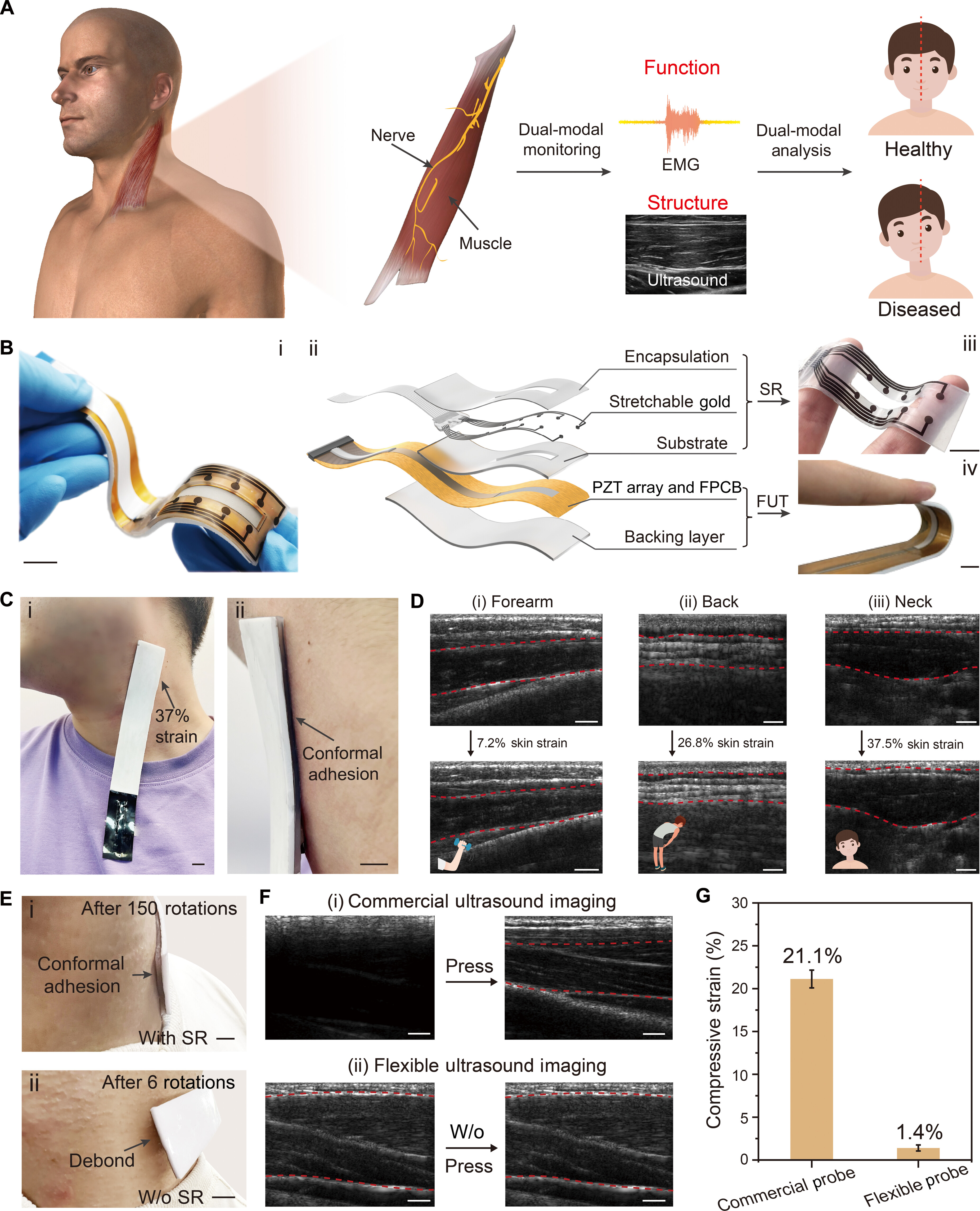 Science Advances | 柔性超声-电生理 “膏药贴”：实现人体“结构与功能”同步原位监测的柔性贴片